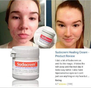 Sudocrem Antiseptic Healing Cream, a well-known multi-purpose skincare solution. 60g